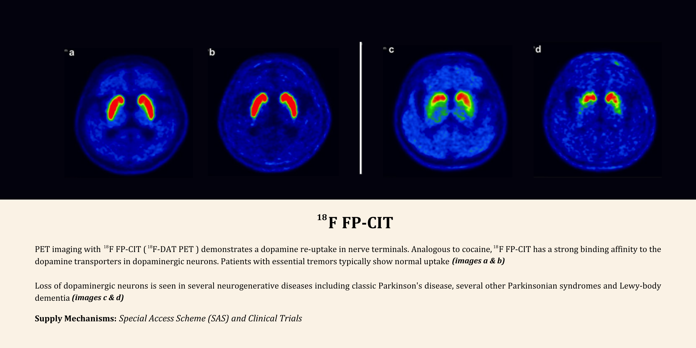 Cyclotek validates to cGMP 18F FPCIT (PET DAT Scan) for use in