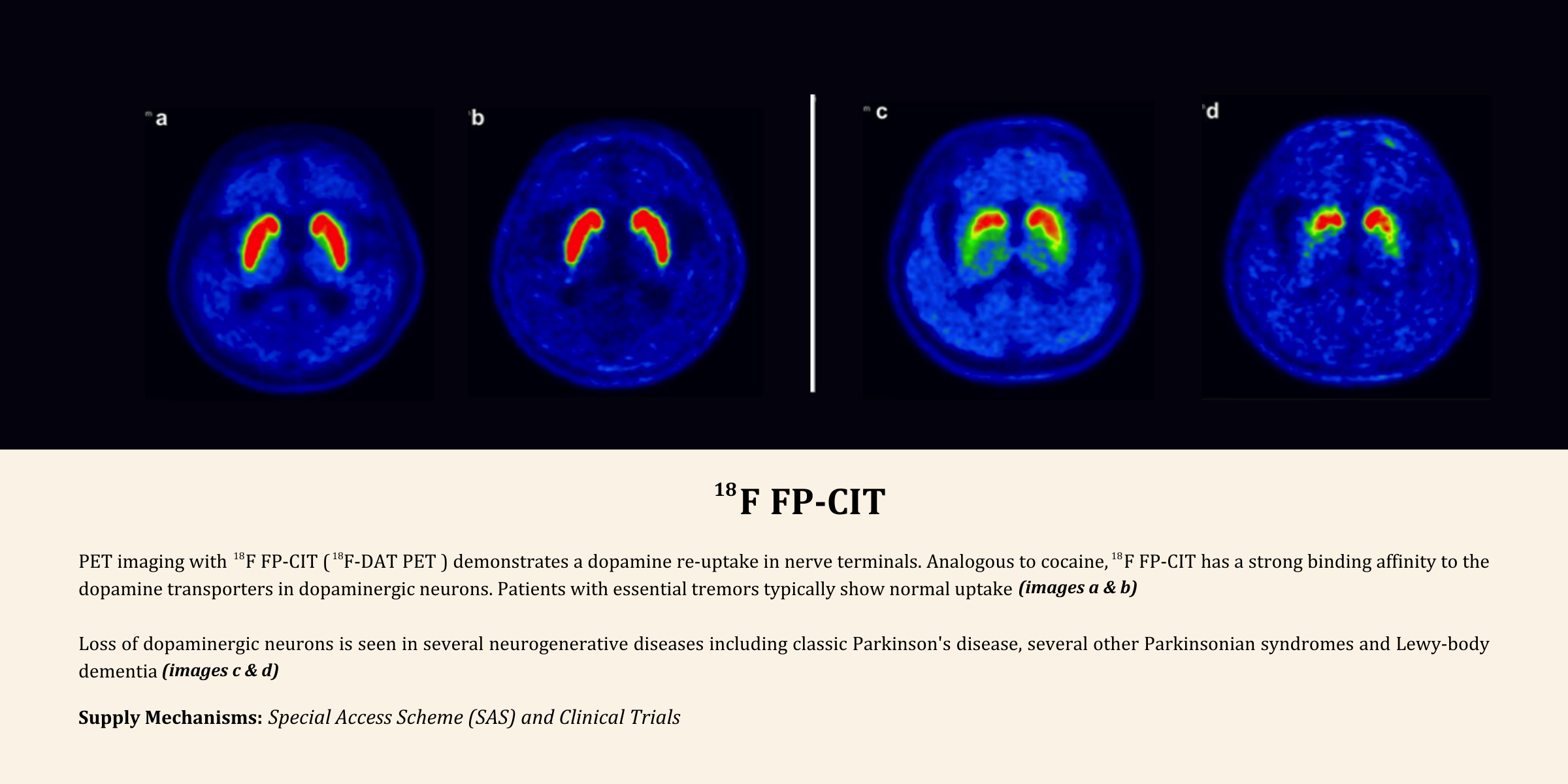genoeg Invloed Overdreven Cyclotek validates to cGMP 18F FP-CIT (PET DAT Scan) for use in Parkinson  Disease - Cyclotek